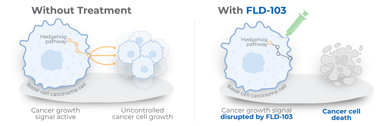 FLD-103 Mechanism of Action FLD-103 Mechanism of Action