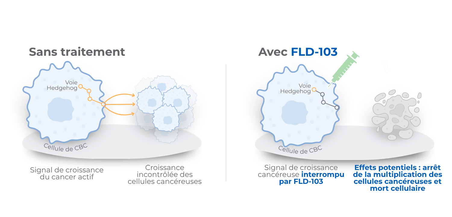 FLD-103 MoA Simplified (Patients)_FR