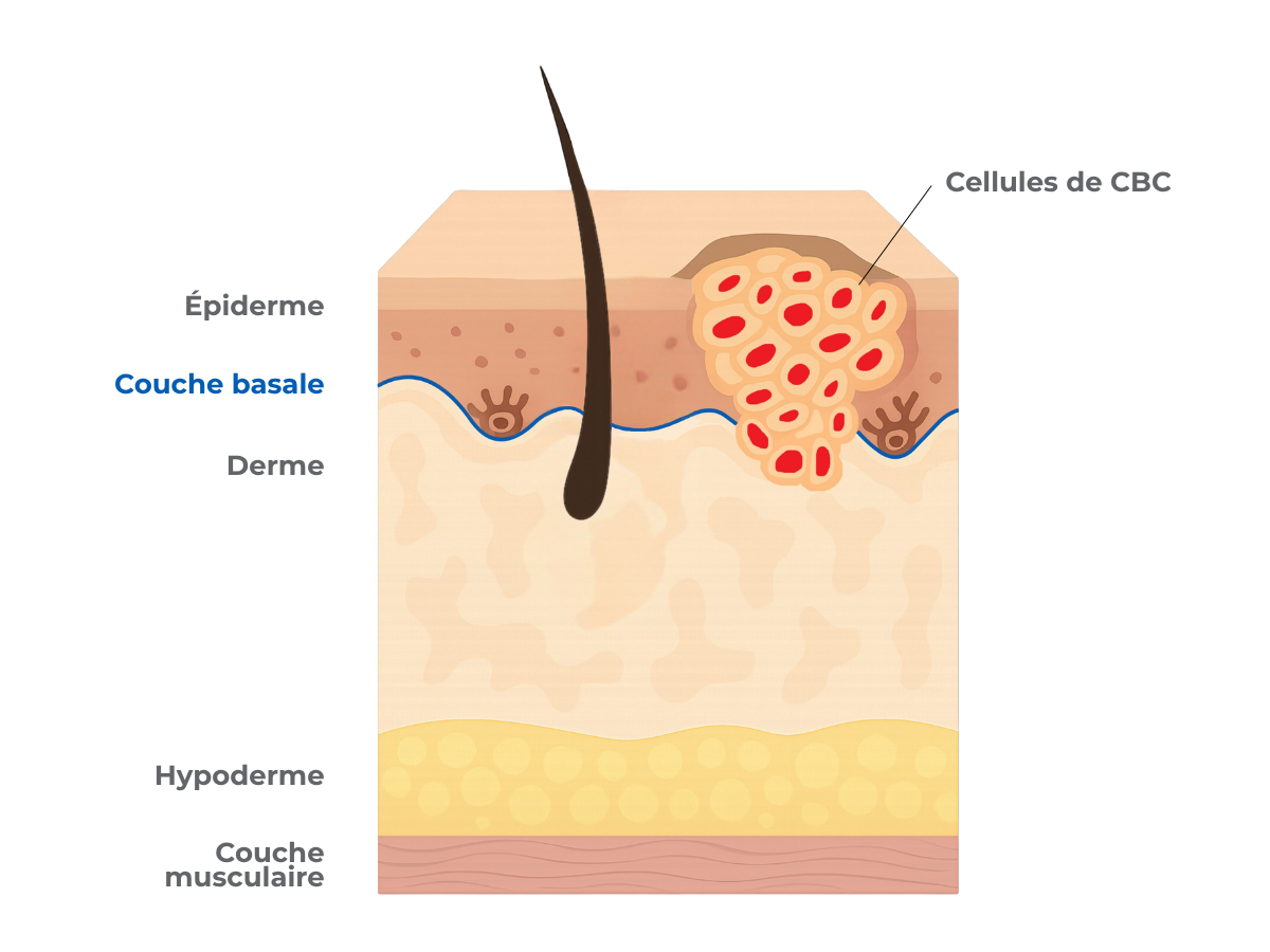 Skin Layers